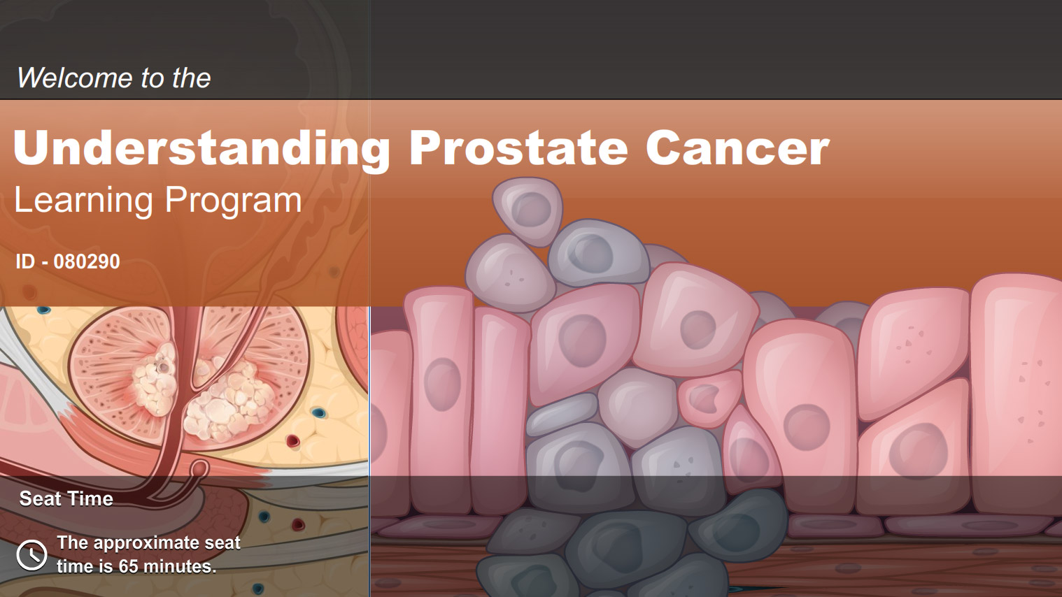 Understanding Prostate Cancer Adam Ondemand 3799